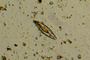 Diatom