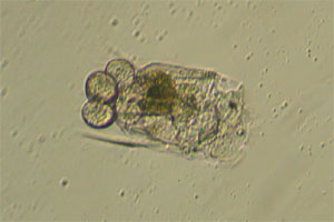 Polyarthra with eggs