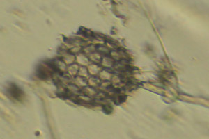 Clathrulina elegans shell