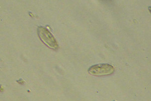 Spirotrichea