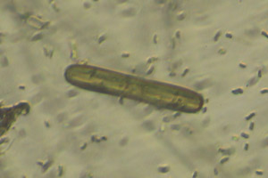 Diatom
