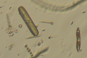 Diatom