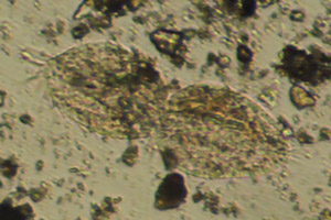 Spirotrich dividing