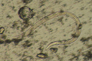 Roundworm