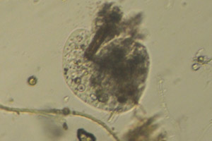 Amoebozoa