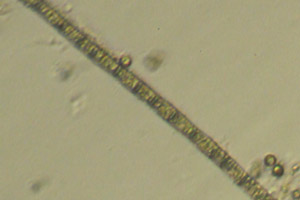 Chlorophyte