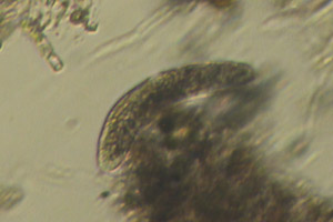 Ciliate