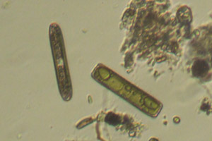 Diatoms