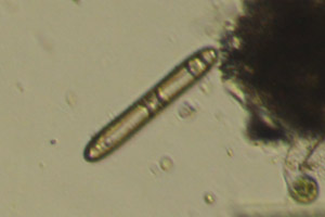 Diatom