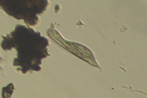 Chaetonotid