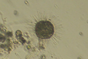 Acanthocystis