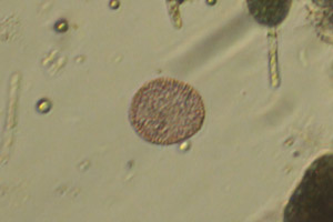 Lamprocystis roseopercisina
